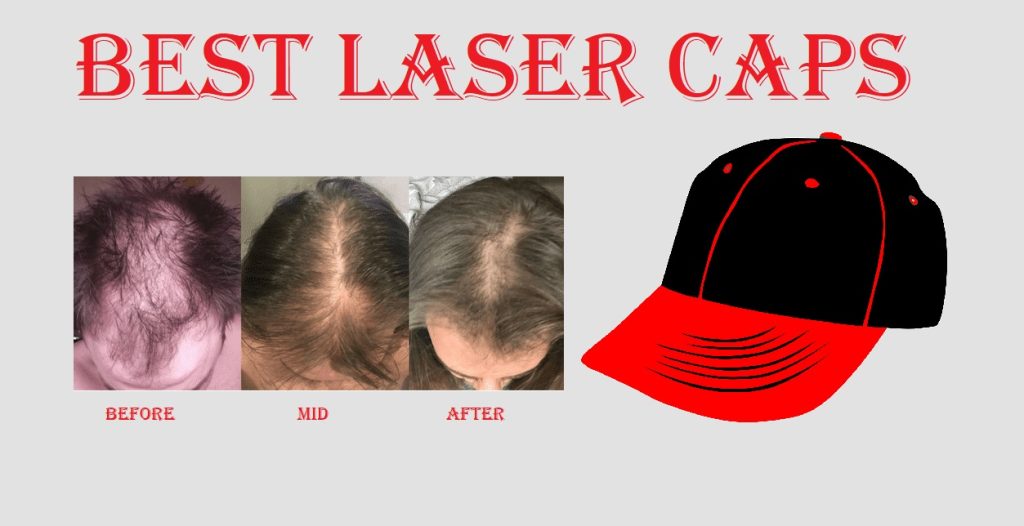 best laser cap for hair loss reviews